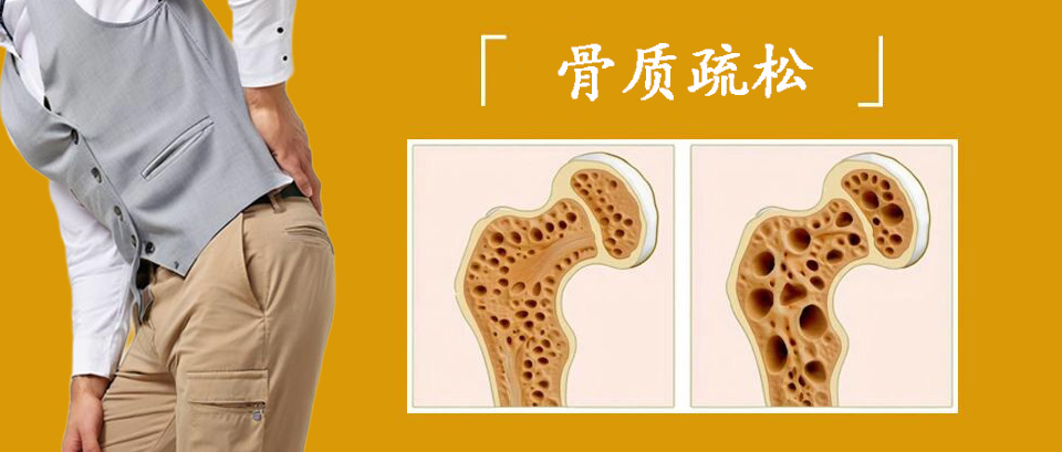 骨质疏松症早期或有3个信号，医生提醒：出现时要重视