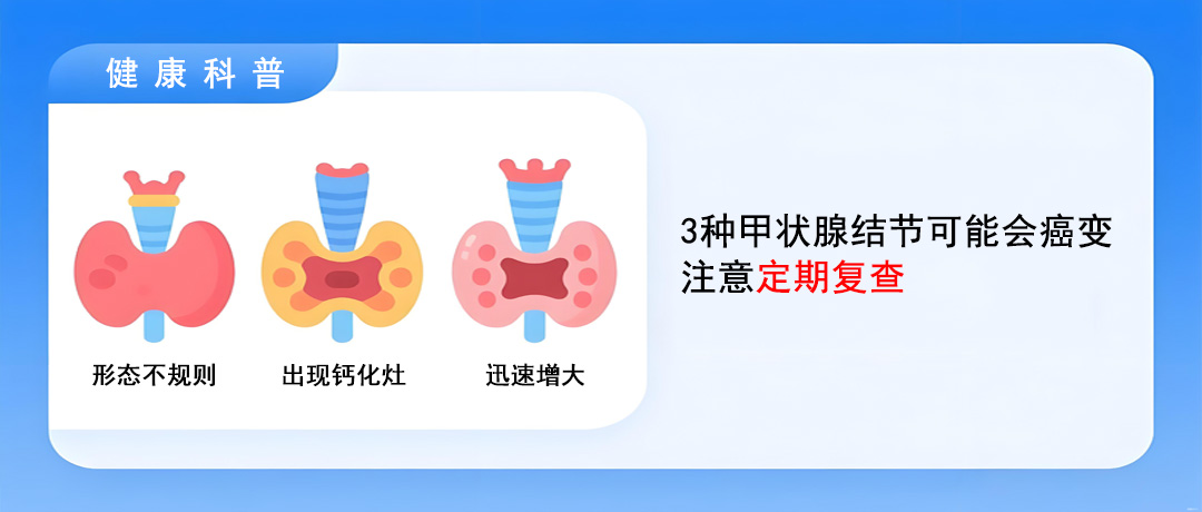 这3种甲状腺结节，可能会癌变，注意定期复查