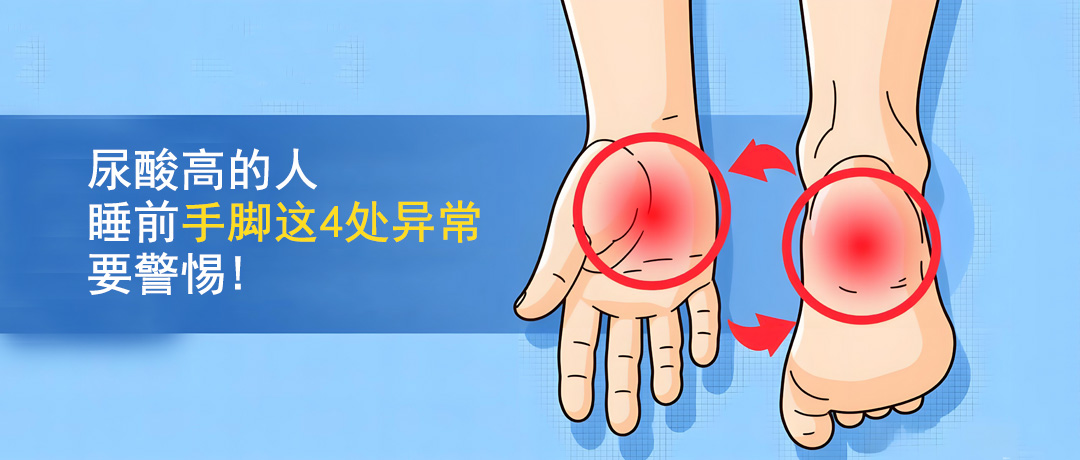 尿酸高的人，睡前手脚这4处异常要警惕!