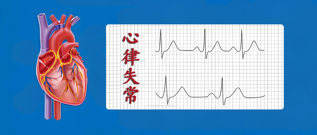 心跳忽快忽慢?可能是心律失常在“预警”